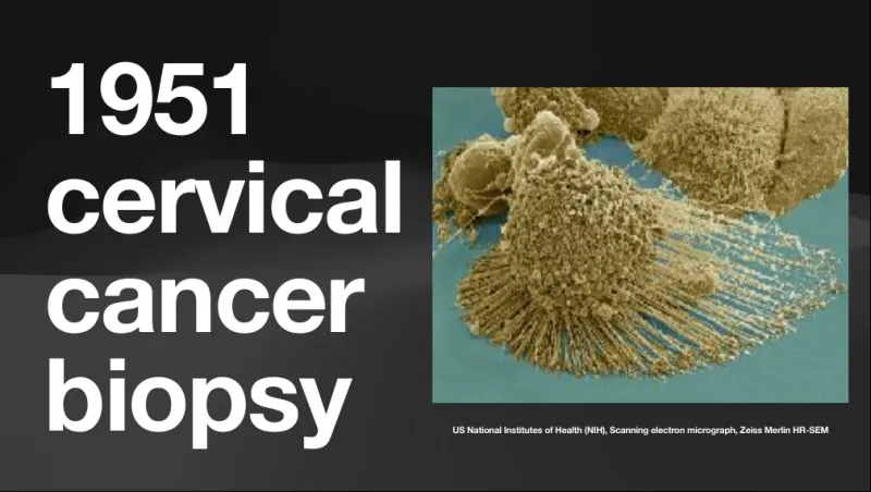 1951 cervical cancer biopsy, NIH scanning electron micrograph